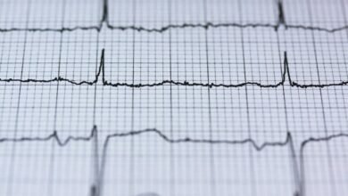 infinite pulse branding sequence